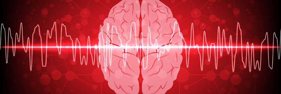 Diplomatura de Vinculación en Neurofisiología Clínica: Electroencefalografía y Video–Electroencefalografía. Modalidad Virtual